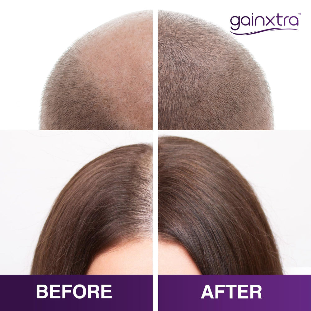GAINXTRA spray on scalp demonstrating fast-absorbing, non-greasy texture