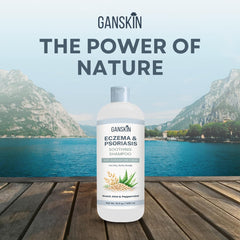 Ganskin before and after scalp comparison showing reduced flakes visually