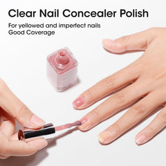 GELLEN nail before and after photo showing corrected tone and smoothed ridges