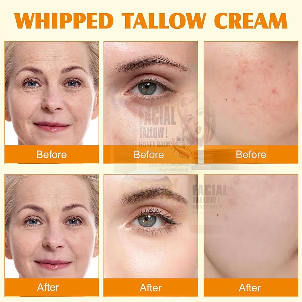 Generic hand applying balm, illustrates targeted hydration for dry spots and hands