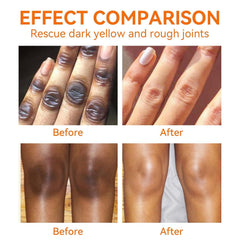 Generic knee and elbow comparison showing improved tone and smoother skin benefit