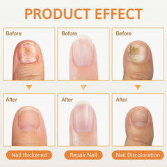 Generic nail texture close-up showing smoother, shinier nails after use