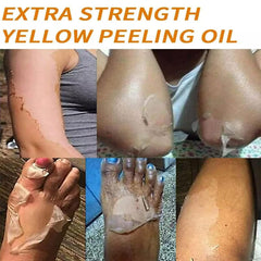Generic peeling oil next to ruler showing 110ml size and travel-friendly benefit