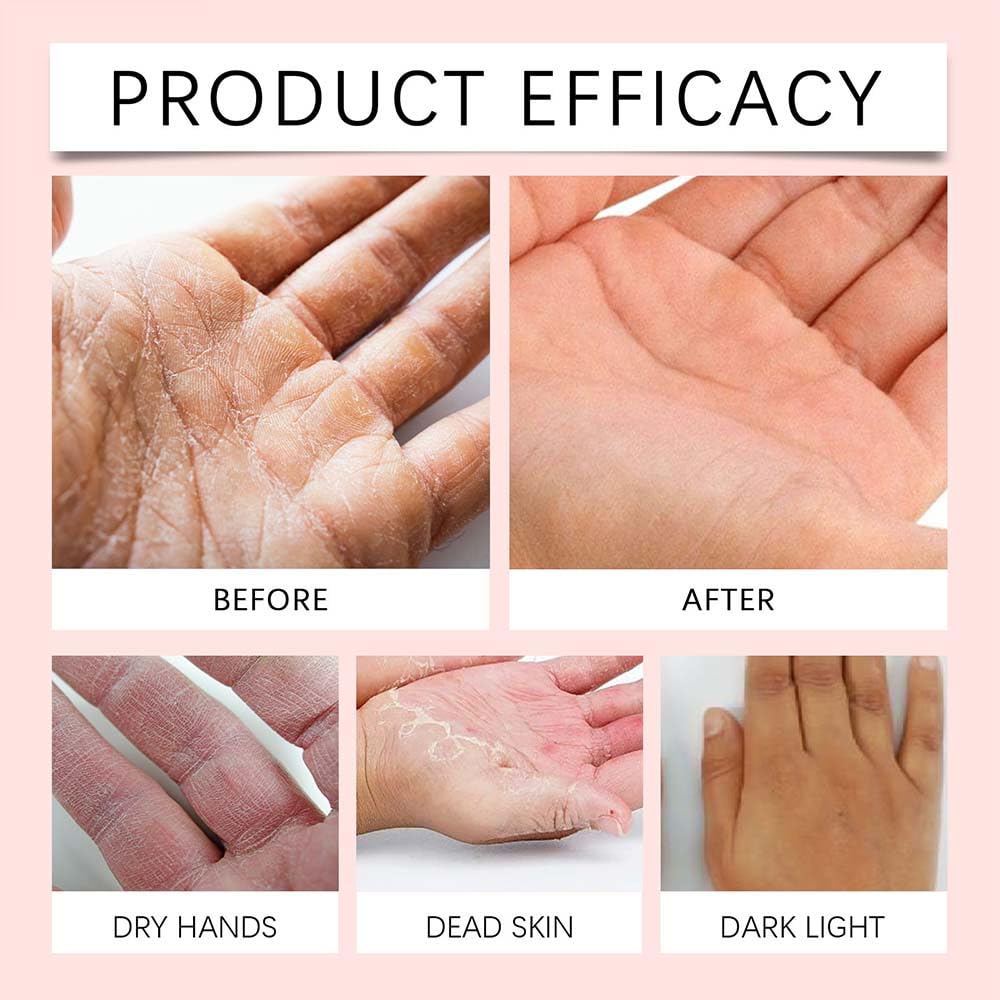 Generic retinol hand cream applied to hands after use showing visibly smoother skin benefit