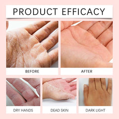 Generic retinol hand cream applied to hands after use showing visibly smoother skin benefit