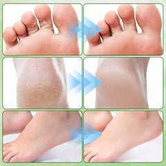 Generic tea tree foot cream being massaged onto heels for softer skin