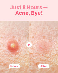 GLAM UP patch applied to cheek demonstrating invisible coverage and protection