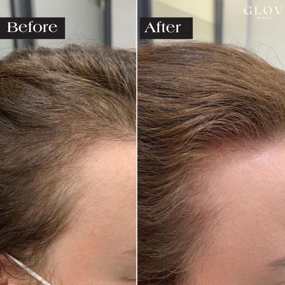 Glov Beauty applicator filled with serum held in hand for easy use