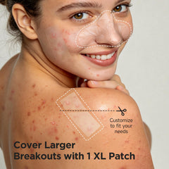 Glowpatch patches applied on nose demonstrating secure overnight wear