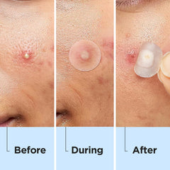 Glowpatch under makeup demonstration showing seamless blending benefit