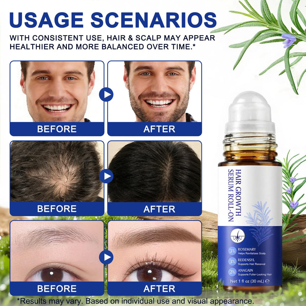 GPUPFJPW roll-on applied to scalp parting showing targeted delivery to follicles