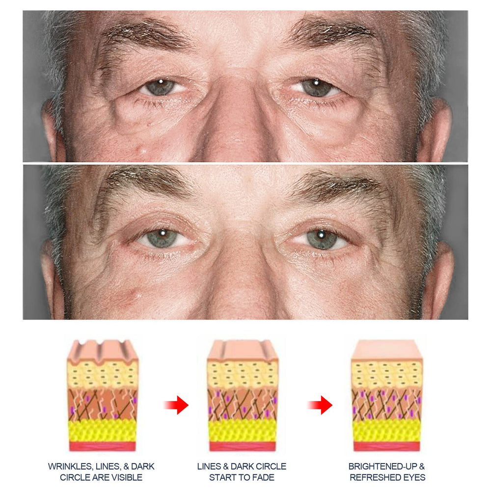 Grospe eye gel applied with ring finger demonstrating gentle patting