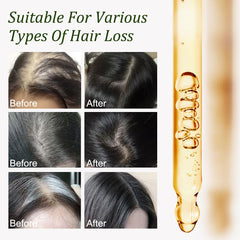 Applying Gypsophila Batana Oil during scalp massage to stimulate circulation and nourishment