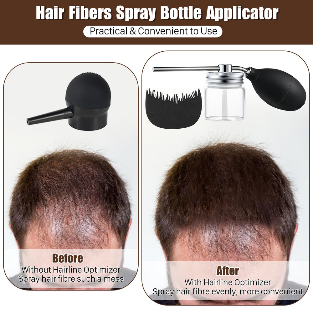 Hohean hairline optimizer attachment demonstrating targeted placement for natural edges