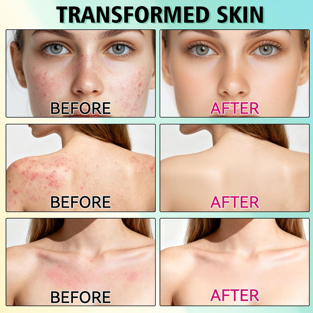 HORSEFISH TOOL before-and-after comparison illustrating improved skin appearance