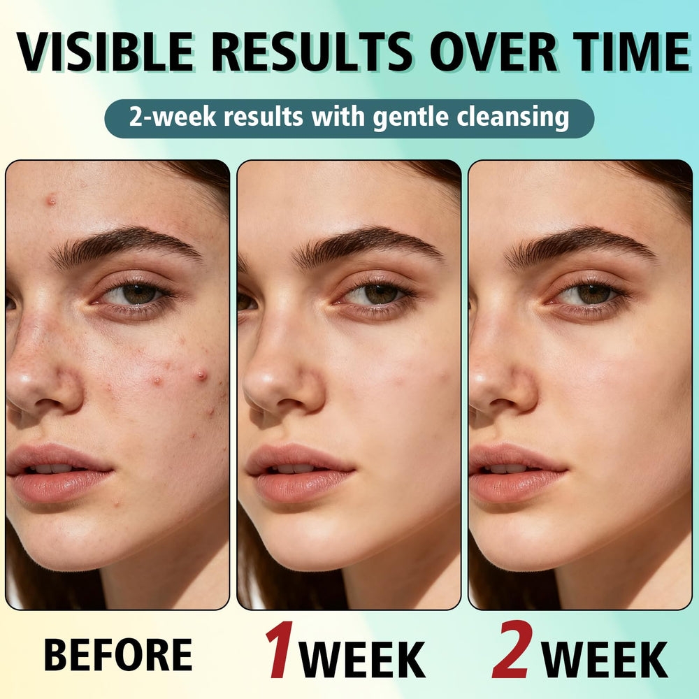 HORSEFISH TOOL ingredients close-up with salicylic acid and niacinamide benefits