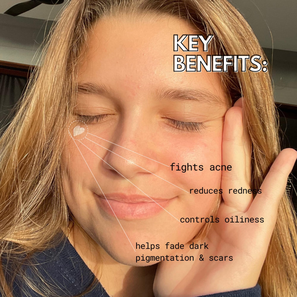 HumanKINDglow heart patch applied to cheek, protects blemish and reduces redness
