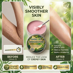 Hyggear balm being smoothed on upper arm demonstrating immediate softening benefit