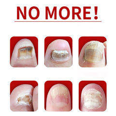 IMOLL used during at-home manicure illustrating stronger, shinier nails
