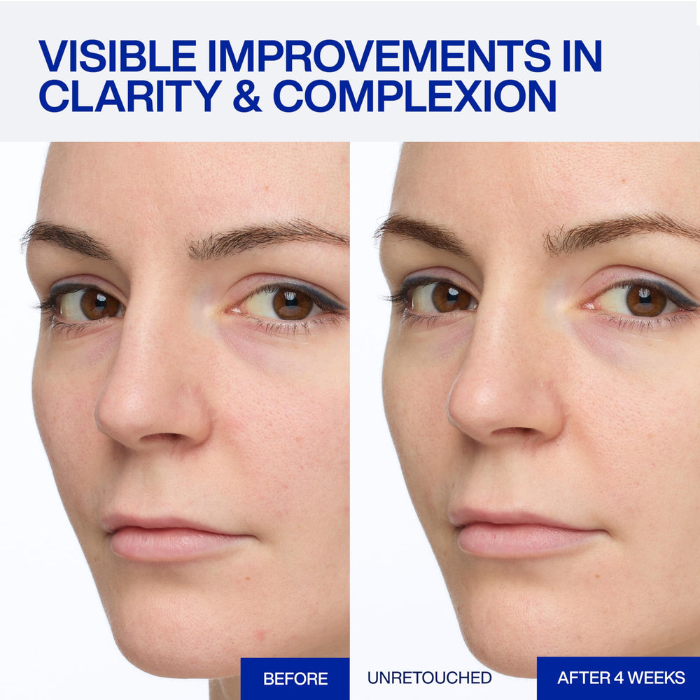 IOPE dropper releasing serum highlighting controlled, hygienic dosing