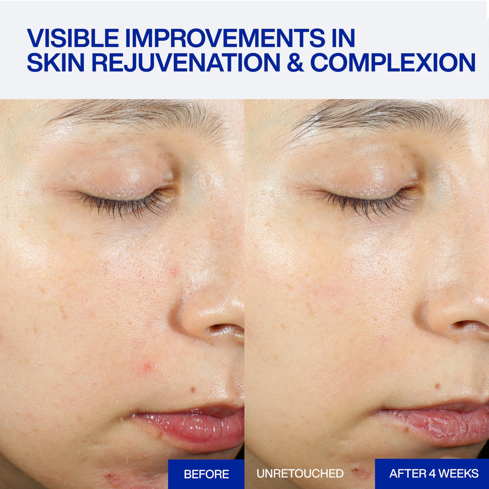 IOPE dropper dispensing serum demonstrating controlled application and energizing effect