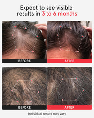 iRestore closeup of lasers and LEDs demonstrating even scalp stimulation