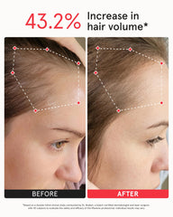 iRestore side view highlighting hairline reach and consistent positioning