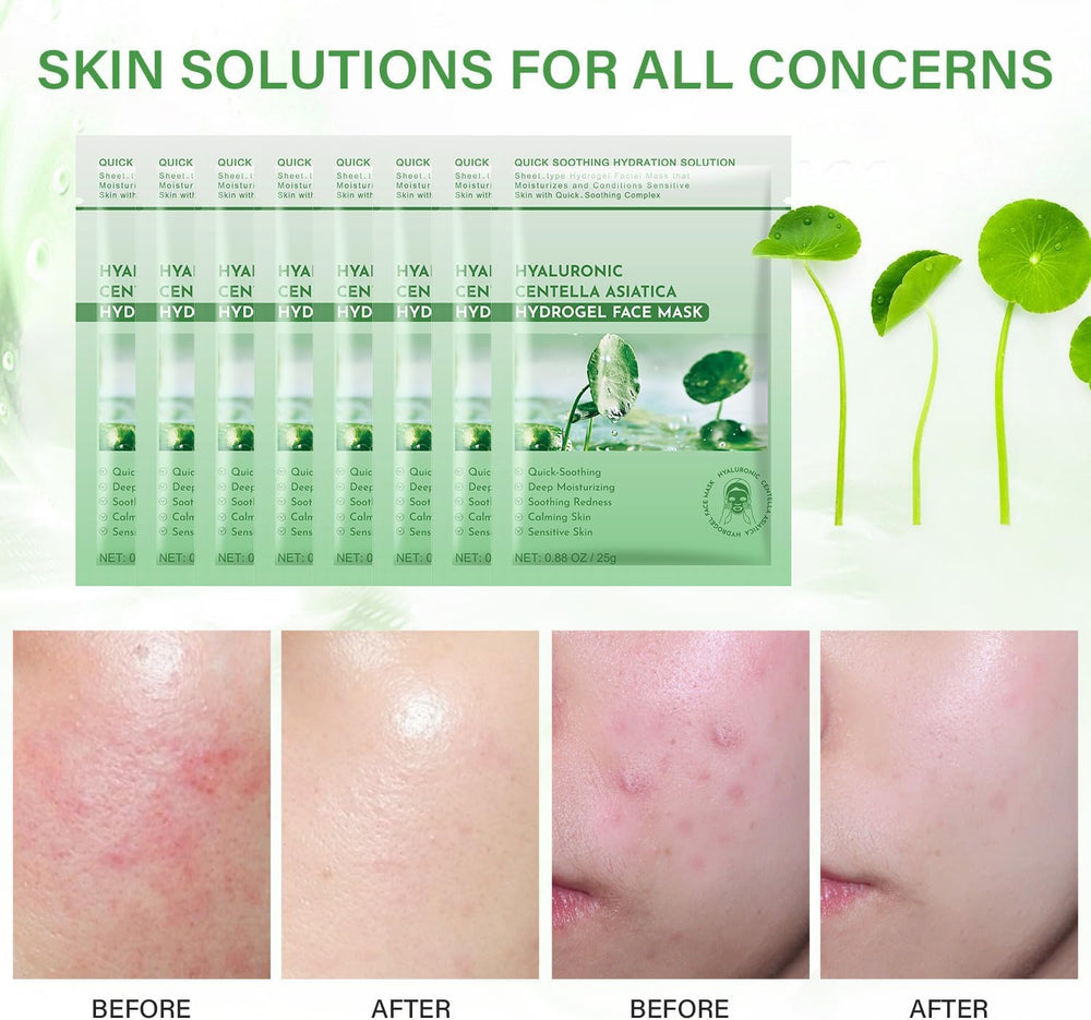 IREV model applying mask on face for immediate soothing relief