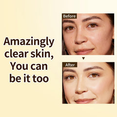 IREV dropper dispensing clear serum for precise application and minimal waste