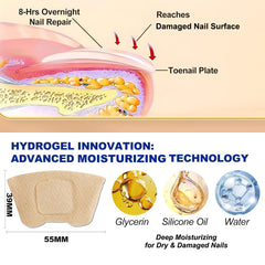 IRSRDOQU patch applied to toenail demonstrating secure fit and overnight wear
