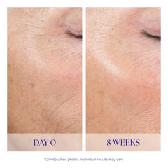 iS CLINICAL application on face demonstrating easy at-home use