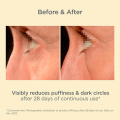 ISDIN before and after under-eye comparison showing brighter skin