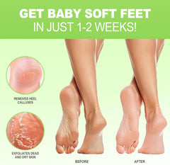 JVR open bootie detail with visible exfoliant gel for easy use