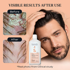 KAMEDIS scalp massage in shower demonstrating soothing action and relief