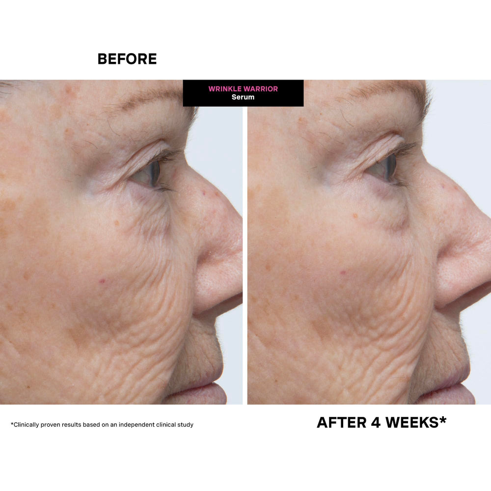 Kate Somerville before and after image showing temporary visible smoothing