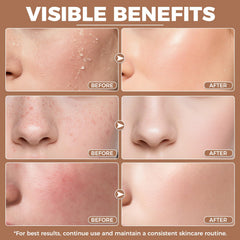 KINGMING applied on hand demonstrating fast absorption and hydrated skin benefit
