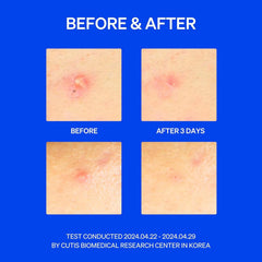 KNEMO two sizes laid out to show size options for precise coverage benefit