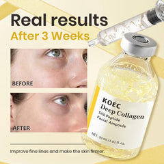 KOEC syringe dispenser inserted into ampoule showing precise dosing benefit