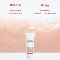 koriderm jar opened with cream visible, demonstrating easy scoop use