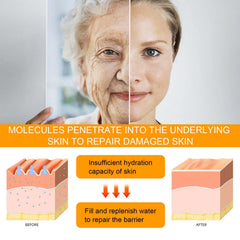 Applying KunMan under-eye cream with patting motion to reduce puffiness