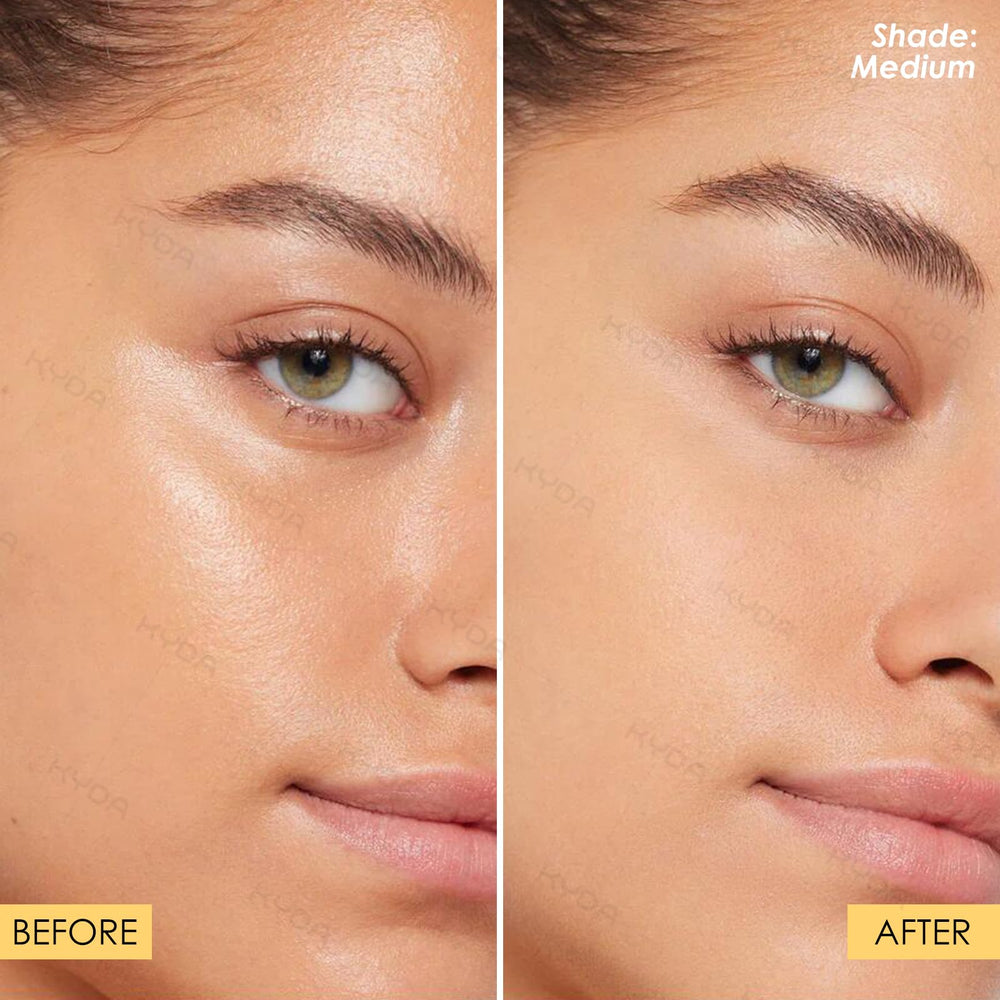 KYDA hairline coverage before and after for reduced shine