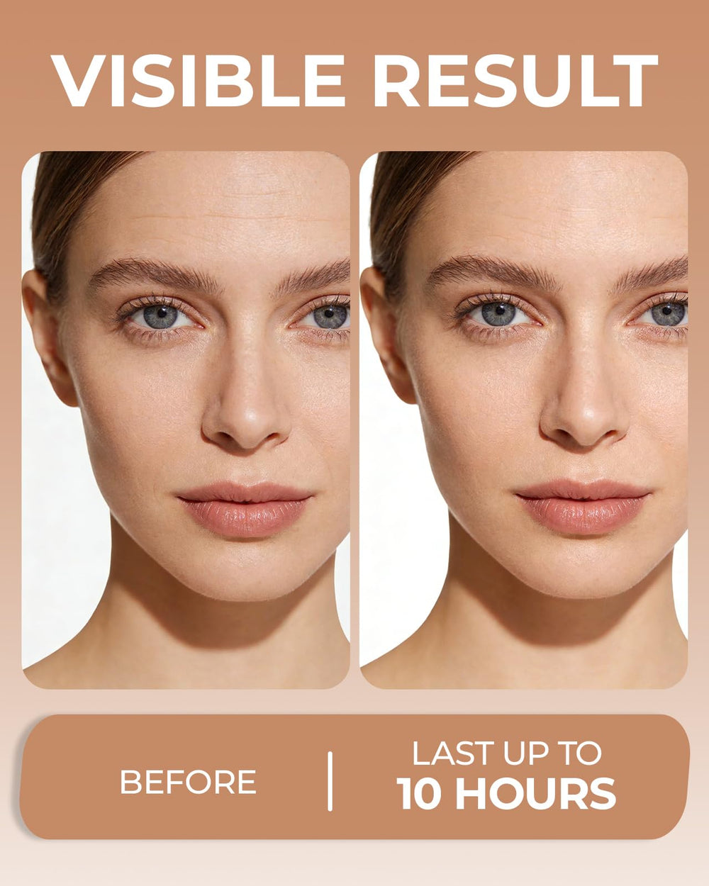 LA.PERSONAL on smile lines showing targeted smoothing and plumping benefit