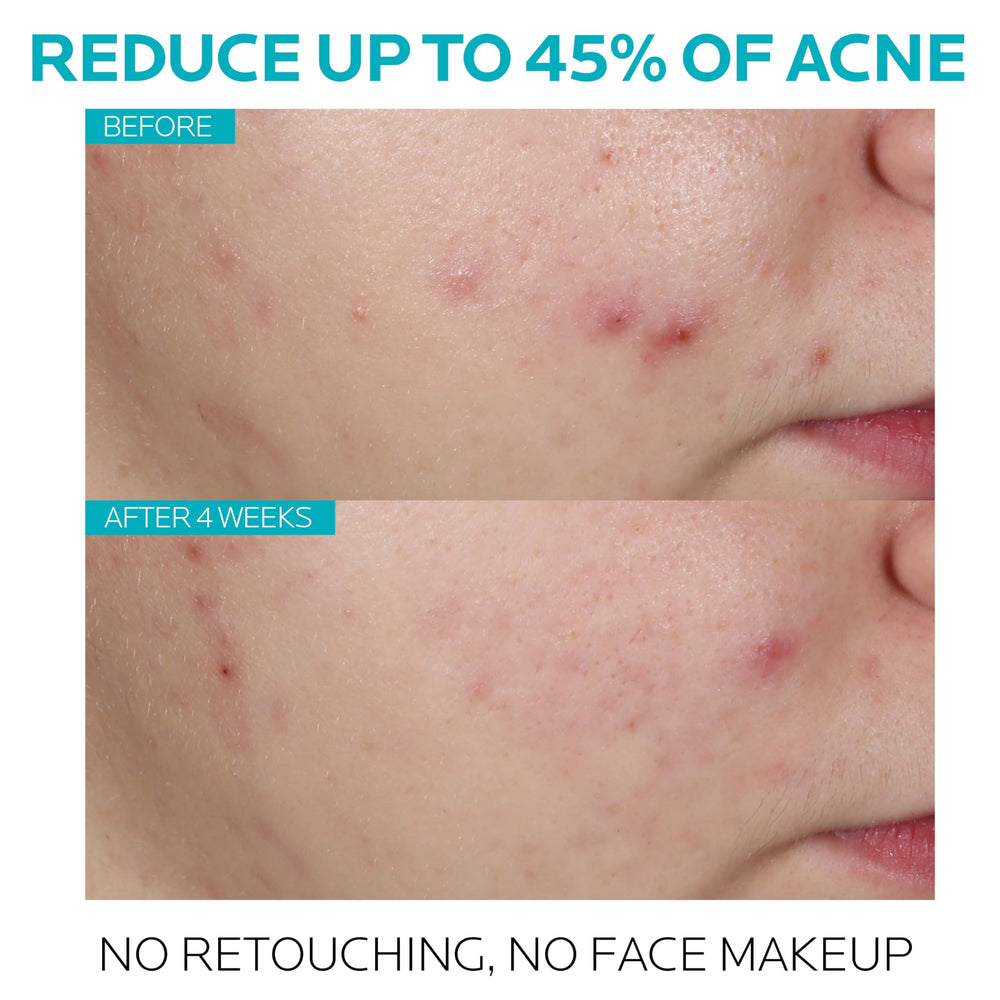 La Roche-Posay serum texture on fingertip illustrating lightweight spreadability