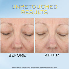 Lancôme visual of niacinamide vitamin Cg and hyaluronic acid benefits on skin