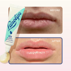 Using Lanolips 101 on cuticles to soften skin and prevent hangnails effectively