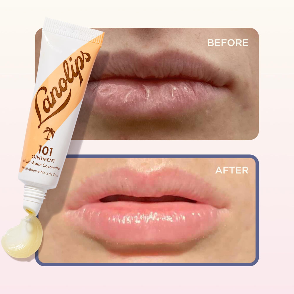 Lanolips elbow before and after showing visible smoothing benefit