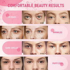 LAVONE before and after comparison demonstrating improved eye texture