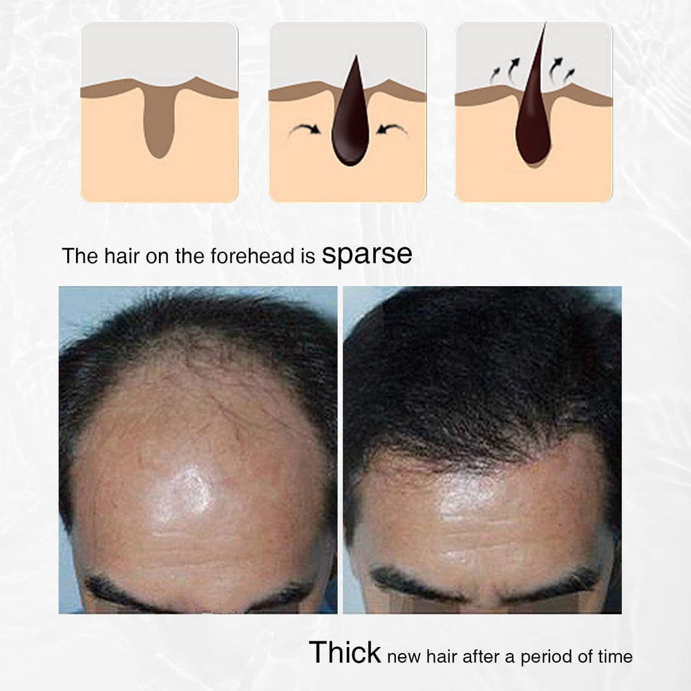LINEDSON applying spray to scalp encouraging targeted follicle care