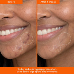 LION POSE ingredient label detail highlighting acid blend