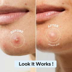 LitBear patch applied on cheek demonstrating protection from picking